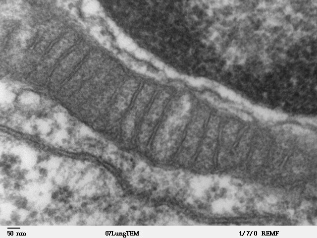 TEM showing a mitochondrion with internal cristae in mammalian lung tissue